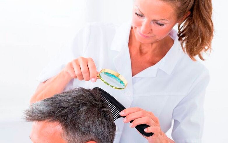 Psoriasis-Behandlung der Kopfhaut