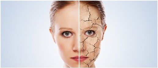 Wir behandeln Psoriasis